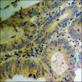 Anti-phospho-PEA-15 (pSer116) antibody produced in rabbit affinity isolated antibody