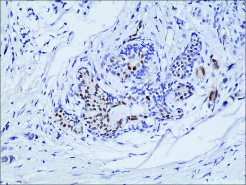 Anti-ER alpha antibody, Rabbit Monoclonal recombinant, expressed in HEK 293 cells, clone RM292, purified immunoglobulin