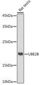Anti-UBE2B Antibody, clone 2Z3R2, Rabbit Monoclonal
