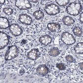 Anti-EVA1C antibody produced in rabbit Prestige Antibodies® Powered by Atlas Antibodies, affinity isolated antibody, buffered aqueous glycerol solution