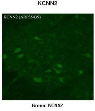 Anti-KCNN2 antibody produced in rabbit affinity isolated antibody