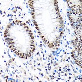 Anti-PBRM1 antibody produced in rabbit