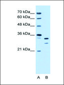Anti-ANP32E antibody produced in rabbit affinity isolated antibody