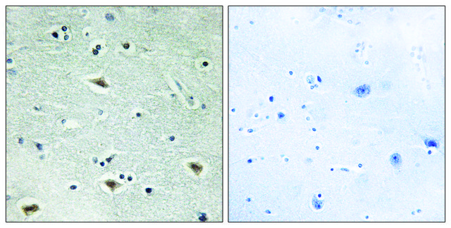 Anti-MTG16 antibody produced in rabbit affinity isolated antibody