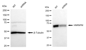 KD-Validated Anti HNRNPM Antibody, clone 23GB4895, Rabbit Monoclonal clone 23GB4895, recombinant rabbit monoclonal, expressed in HEK293 cells
