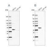 Anti-SERPINB1 antibody produced in rabbit Prestige Antibodies® Powered by Atlas Antibodies, affinity isolated antibody, buffered aqueous glycerol solution