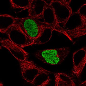 Anti-DYRK1B antibody produced in rabbit Prestige Antibodies&#174; Powered by Atlas Antibodies, affinity isolated antibody