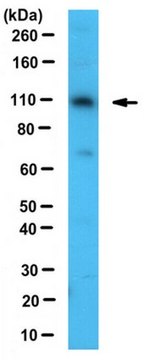 Anti-E6AP Antibody serum, from rabbit