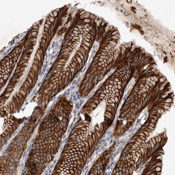 Anti-DHDDS antibody produced in rabbit Prestige Antibodies&#174; Powered by Atlas Antibodies, affinity isolated antibody, buffered aqueous glycerol solution, Ab1