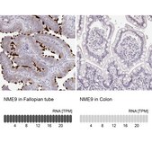 Anti-NME9 antibody produced in rabbit Prestige Antibodies® Powered by Atlas Antibodies, affinity isolated antibody, buffered aqueous glycerol solution