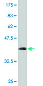 Monoclonal Anti-NPC2 antibody produced in mouse clone 4B9, purified immunoglobulin, buffered aqueous solution