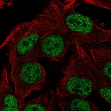 Anti-ST6GALNAC3 antibody produced in rabbit Prestige Antibodies&#174; Powered by Atlas Antibodies, affinity isolated antibody