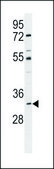 ANTI-ALKBH6 (CENTER) antibody produced in rabbit IgG fraction of antiserum, buffered aqueous solution