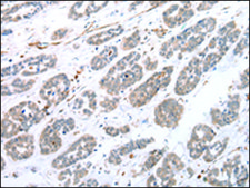 Anti-CPT1C affinity isolated antibody