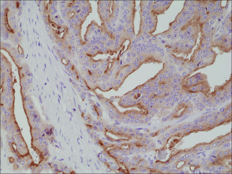 Anti-PSMA antibody, Rabbit monoclonal recombinant, expressed in HEK 293 cells, clone RM327, purified immunoglobulin