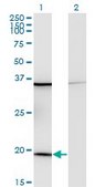 Monoclonal Anti-RPL17 antibody produced in mouse clone 3G11, purified immunoglobulin, buffered aqueous solution