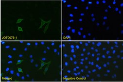 Alpaca Anti-mCherry, recombinant single domain Antibody Recombinant Alpaca(VHH) Nano antibody