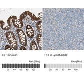 Anti-TST antibody produced in rabbit Prestige Antibodies® Powered by Atlas Antibodies, affinity isolated antibody, buffered aqueous glycerol solution