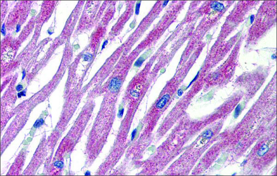 Anti-PLEKHH2 antibody produced in rabbit affinity isolated antibody