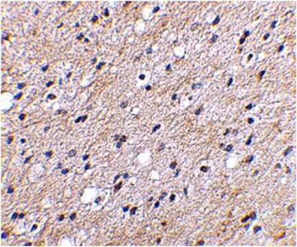 Anti-NIPSNAP Antibody from rabbit, purified by affinity chromatography