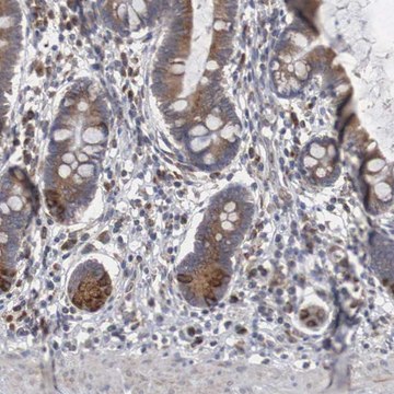 Anti-CTAGE5 antibody produced in rabbit Prestige Antibodies&#174; Powered by Atlas Antibodies, affinity isolated antibody, buffered aqueous glycerol solution