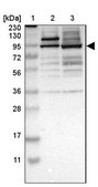 Anti-ZKSCAN5 antibody produced in rabbit Prestige Antibodies® Powered by Atlas Antibodies, affinity isolated antibody, buffered aqueous glycerol solution