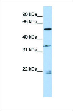 Anti-DPYSL2 antibody produced in rabbit affinity isolated antibody