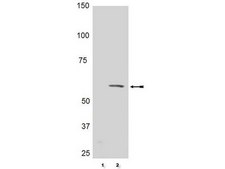 Anti-phospho-Akt (Thr308) Antibody, clone 50-1C-25, rabbit monoclonal clone NL50, Upstate®, from rabbit