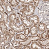 Anti-AKAP7 antibody produced in rabbit Prestige Antibodies® Powered by Atlas Antibodies, affinity isolated antibody, buffered aqueous glycerol solution