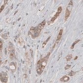 Monoclonal Anti-HMGCR antibody produced in mouse Prestige Antibodies® Powered by Atlas Antibodies, clone CL0259, purified immunoglobulin, buffered aqueous glycerol solution