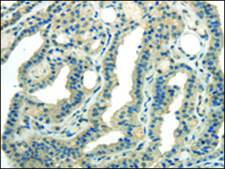 Anti-CD70 affinity isolated antibody