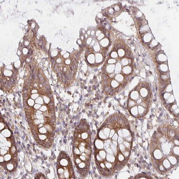 Anti-PDAP1 antibody produced in rabbit Prestige Antibodies&#174; Powered by Atlas Antibodies, affinity isolated antibody, buffered aqueous glycerol solution