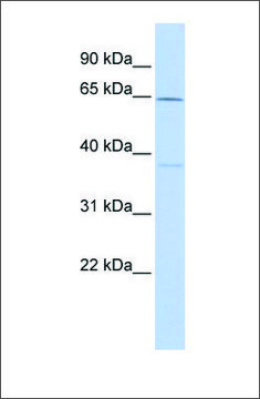 Anti-CACNB1 antibody produced in rabbit affinity isolated antibody