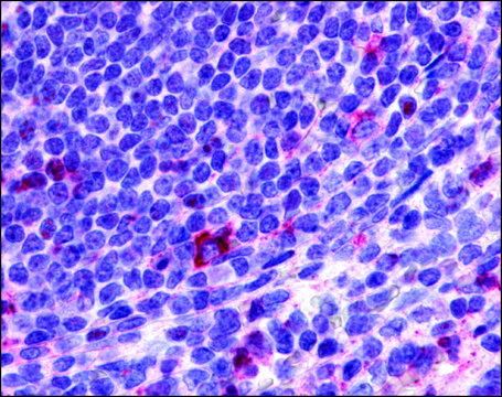 Anti-CCR2 antibody produced in rabbit affinity isolated antibody