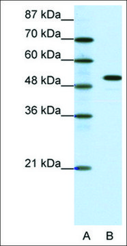 Anti-SPIB antibody produced in rabbit affinity isolated antibody