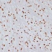 Anti-Phospho-CHEK1-S280 antibody produced in rabbit