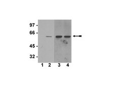 Anti-phospho-Akt1/PKBα (Ser473) Antibody, clone SK703, rabbit monoclonal clone SK703, Upstate®, from rabbit