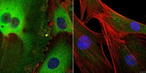 Anti-eIF-4E from rabbit, purified by affinity chromatography