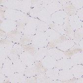 Anti-ATP6V1F antibody produced in rabbit Prestige Antibodies® Powered by Atlas Antibodies, affinity isolated antibody, buffered aqueous glycerol solution