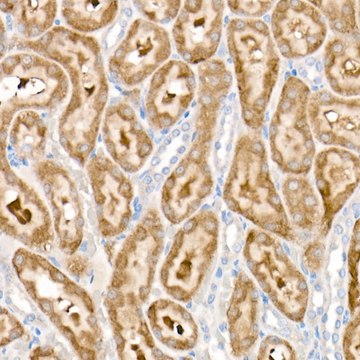 Anti-PDK1/PDHK1 Antibody, clone 5T6S8, Rabbit Monoclonal