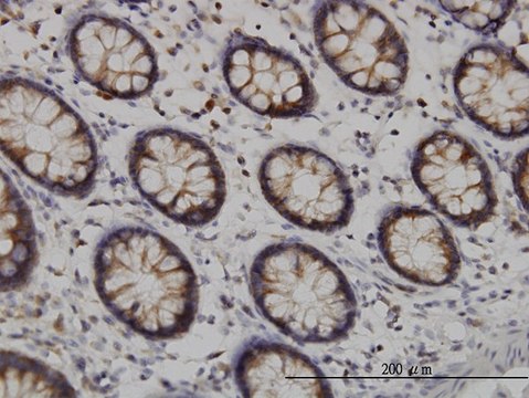 Monoclonal Anti-TYK2 antibody produced in mouse clone 6G12, purified immunoglobulin, buffered aqueous solution