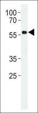 ANTI-P53 (S315) antibody produced in rabbit affinity isolated antibody, buffered aqueous solution