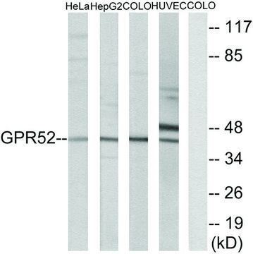 Anti-GPR52 antibody produced in rabbit affinity isolated antibody