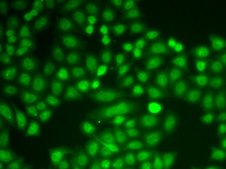 Anti-ASC/TMS1 antibody produced in rabbit