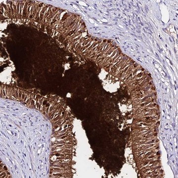 Anti-DEFB106B antibody produced in rabbit Prestige Antibodies&#174; Powered by Atlas Antibodies, affinity isolated antibody, buffered aqueous glycerol solution