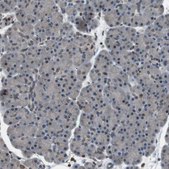 Anti-TMX4 antibody produced in rabbit Prestige Antibodies® Powered by Atlas Antibodies, affinity isolated antibody, buffered aqueous glycerol solution
