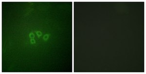 Anti-EIF4B antibody produced in rabbit affinity isolated antibody