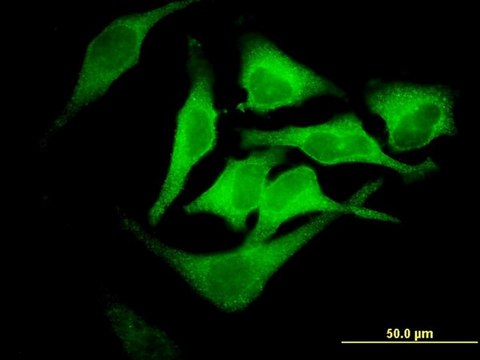 Monoclonal Anti-EPB42, (C-terminal) antibody produced in mouse clone 2G12, purified immunoglobulin, buffered aqueous solution