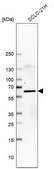Anti-LHX9 antibody produced in rabbit Prestige Antibodies® Powered by Atlas Antibodies, affinity isolated antibody, buffered aqueous glycerol solution
