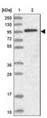 Anti-CTNNA1 antibody produced in rabbit Prestige Antibodies® Powered by Atlas Antibodies, affinity isolated antibody, buffered aqueous glycerol solution